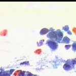 Κύτταρα ενδομητρίου